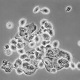 Vaginal Discharge Analysis